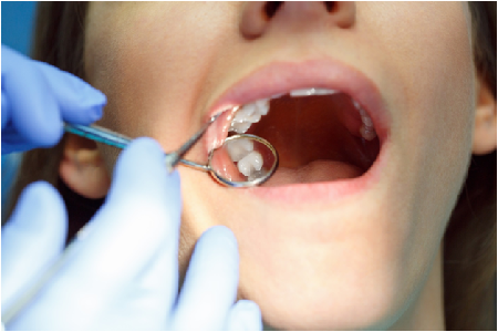 dentist in West Hollywood